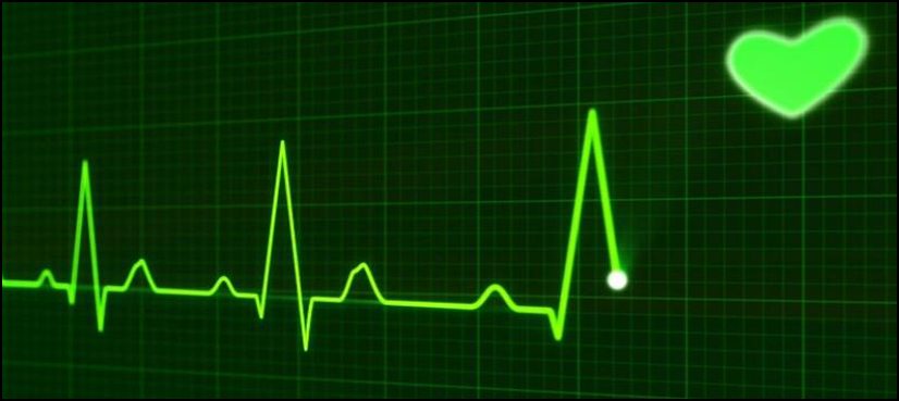 heart rhythm