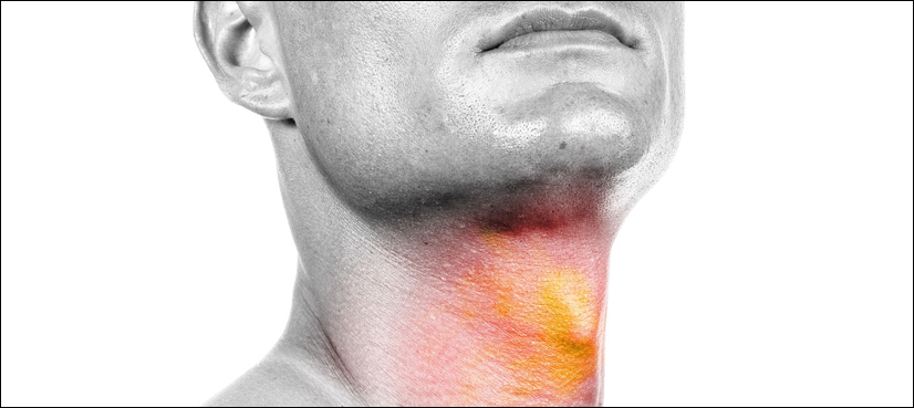 head neck cancer