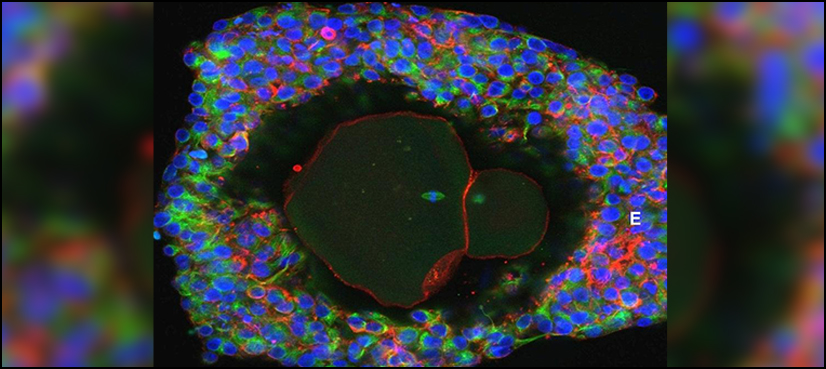 human eggs