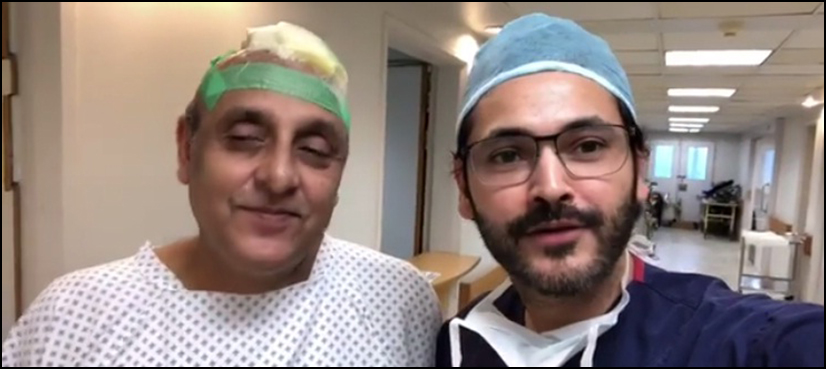 Sajid Hasan hair transplant surgery