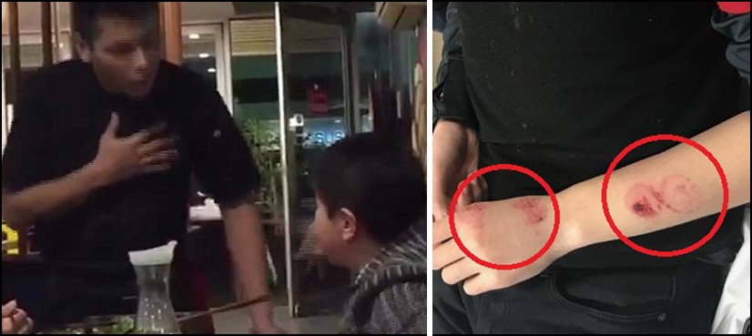woman bites waiter