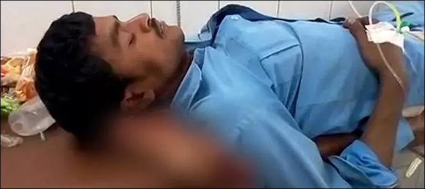 doctors severed leg India