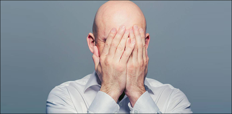 Five healthy ways overcome baldness