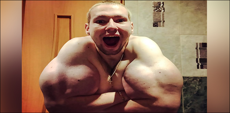 Bodybuilder injects oil into biceps to become 'Popeye'