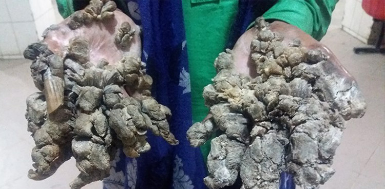 tree man
