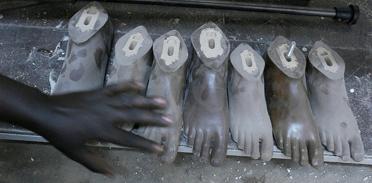 Limb South Sudan amputees