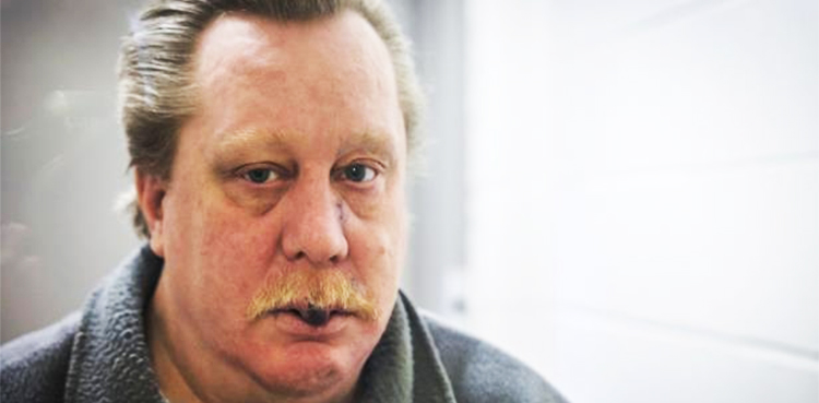 Russel Bucklew, US Supreme Court, rare medical condition, death penalty,
