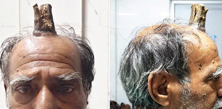 Devil horn on man head