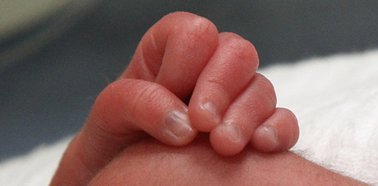 quadruplets birth Sargodha woman birth