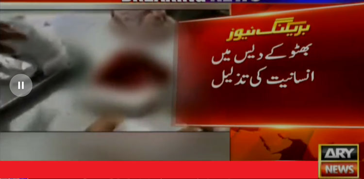 Larkana dog bite