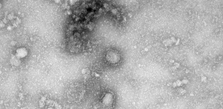 coronavirus