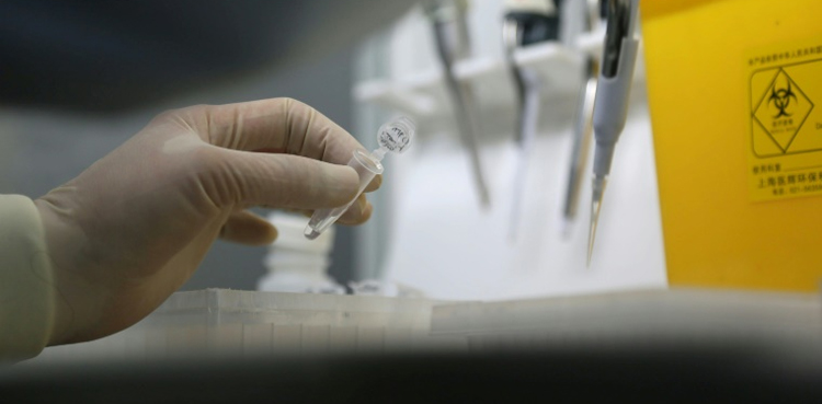 Coronavirus Detection