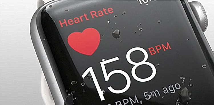 Apple Watch iPad