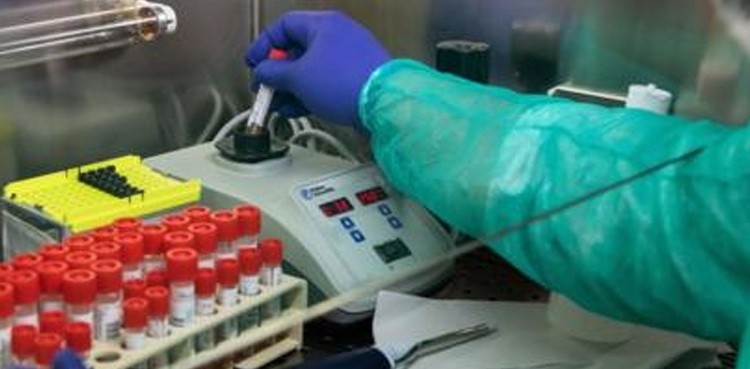 COVID-19 antibody test