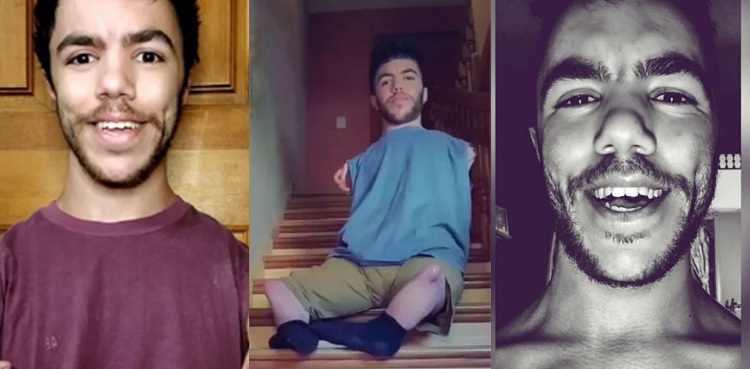 Differently abled Colby Van Voorhis TikTok sensation