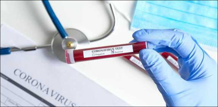 Free coronavirus test Karachi Abbasi Shaheed Hospital
