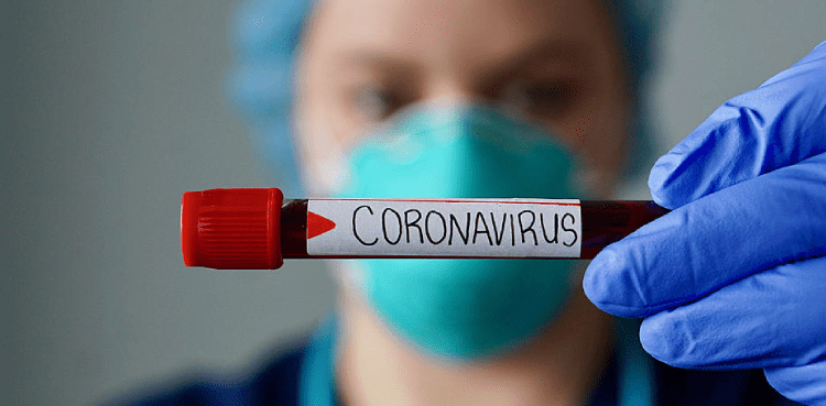 Coronavirus Test Result SMS