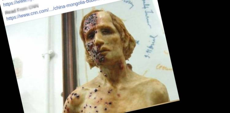 bubonic plague