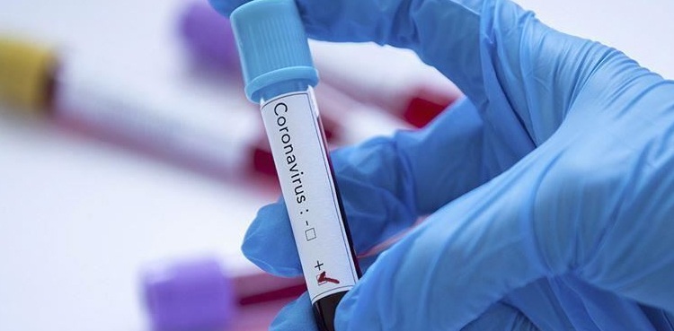 Sindh coronavirus cases
