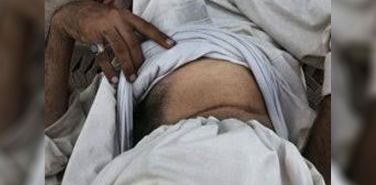Rawalpindi, Organ trafficking, Organ transplant, Man lured with job, Job offer , kidney