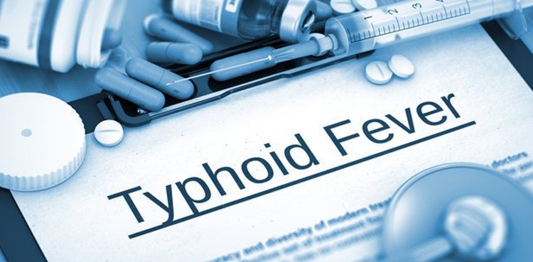 Karachi witnesses spike in XDR typhoid cases