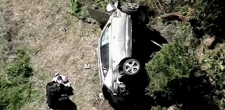 tiger woods leg injuries car crash los angeles