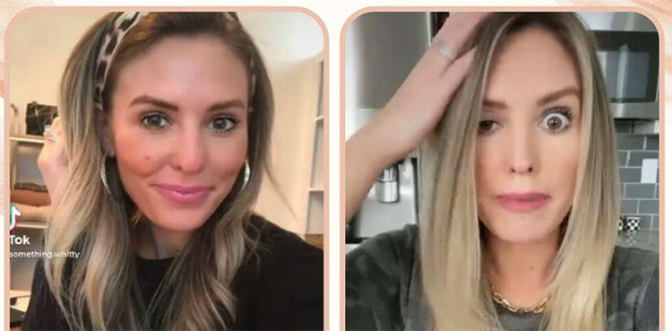 blogger, drooping eyelid, botox
