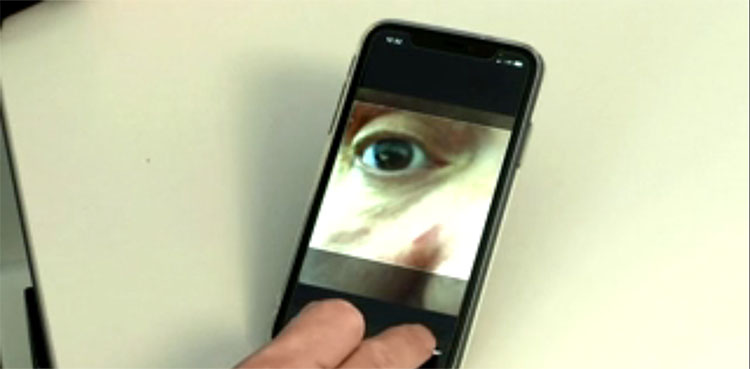 eye scan test, coronavirus, german company, testing