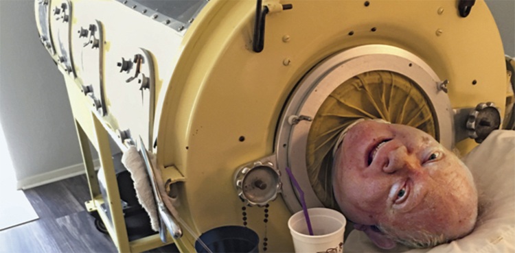 iron lung machine, Paul Alexander, polio