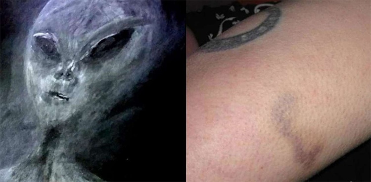 abduction, woman, aliens, bruises
