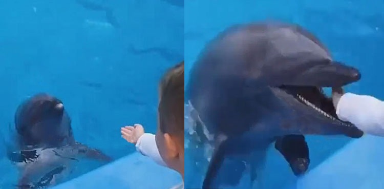 dolphin bites young boy hand