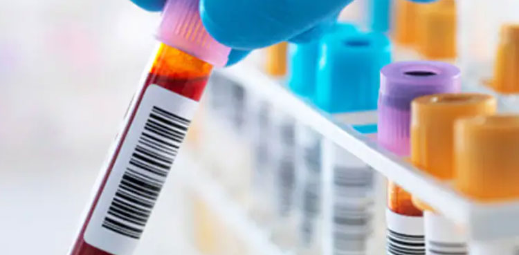 oxford researchers vaccine efficacy