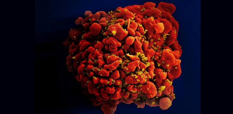 HIV patient cure