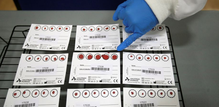 uk covid antibody testing general public