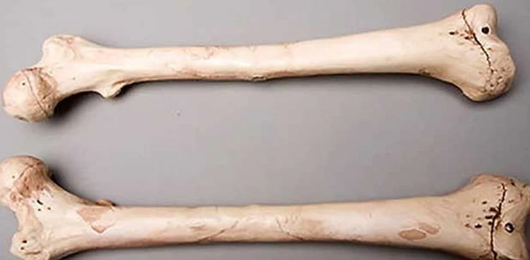 human bones sack empty plot lahore defence