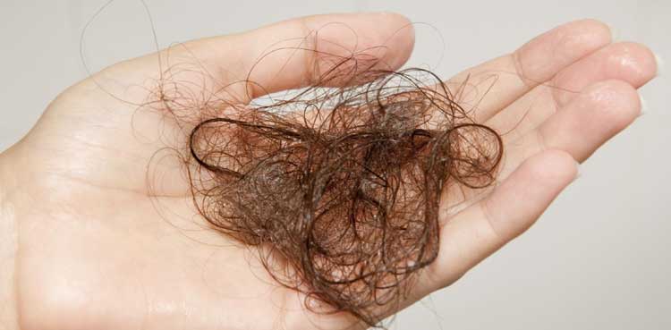 hairfall treatment