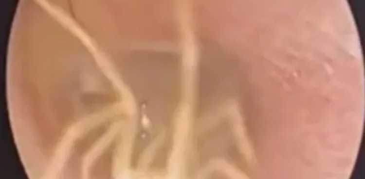 doctor spider patients ear