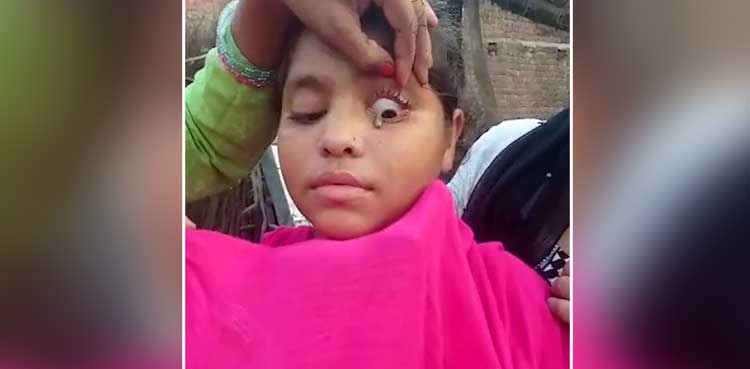 stones, girl, eye