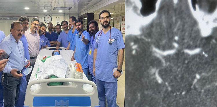 NICVD Paralysis Stroke Treatment
