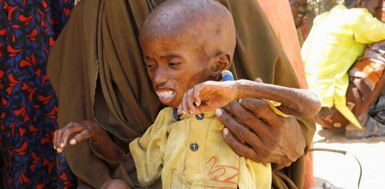 Somalia drought children famine