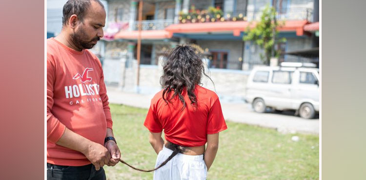 Man grows tail, Viral, Teenager, Nepal