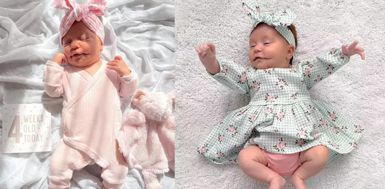 rare condition, baby, baby born,