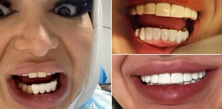 woman dental procedure botched procedure teeth