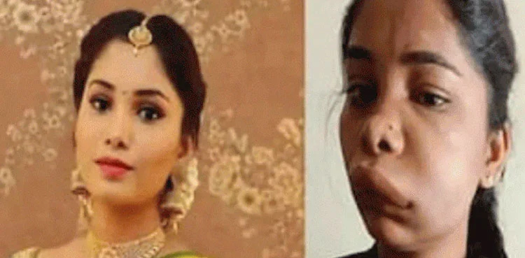 Swathi Satish, actor, botched surgery, Kannada