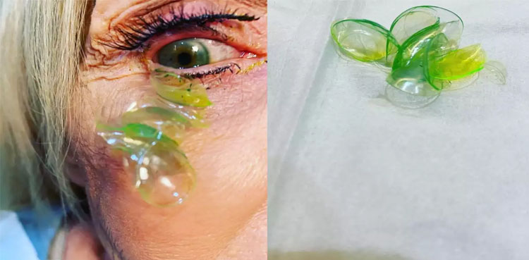 Viral Video contact lenses