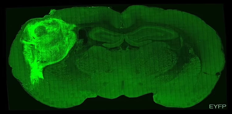 Hybrid-brain,-rat,-autism.