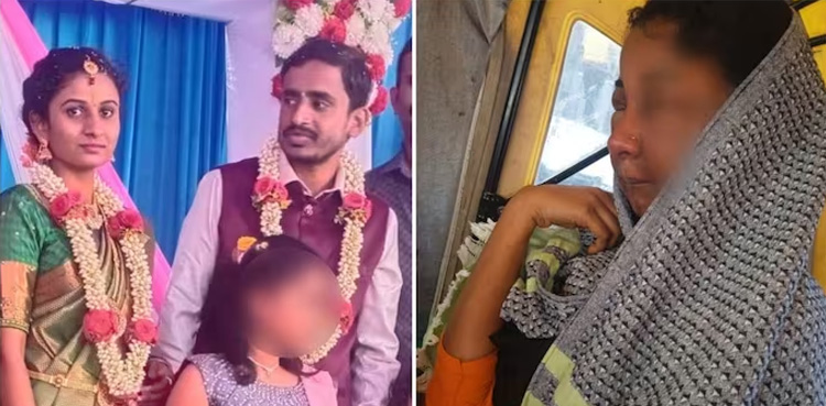 Makeup goes wrong, bride's face disfigured