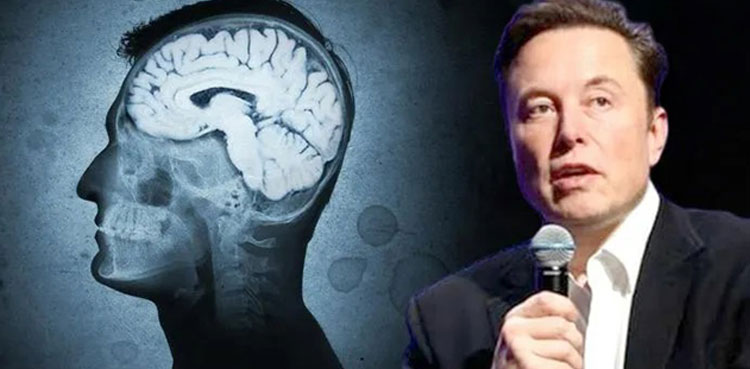Elon Musk's Neuralink says cleared for human test of brain implants