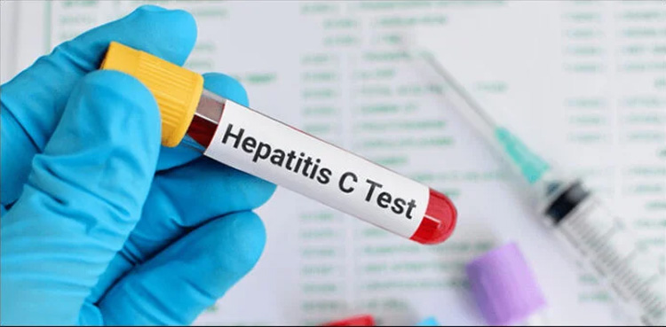 Hepatitis C screening