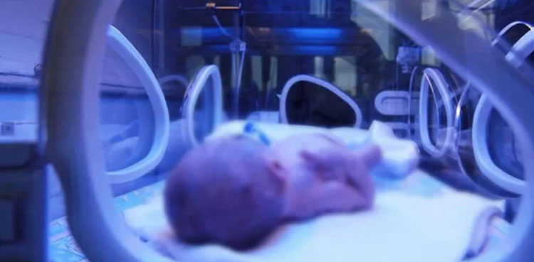 Lahore-infant , Infant suffers burns , overheating in incubator, Lahore , Ganga Ram Hospital